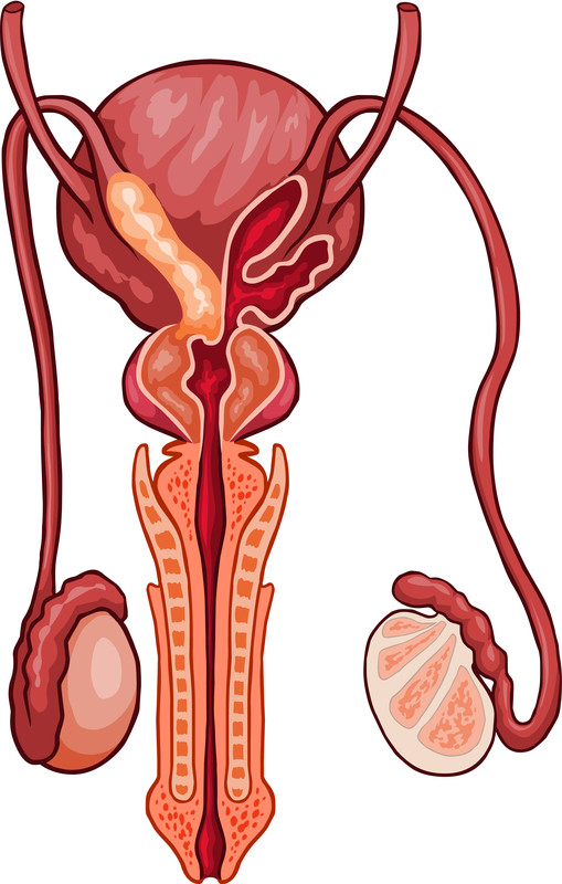 การอุดตันในส่วนของท่อส่งอสุจิ - กุลพัฒน์การแพทย์ สหคลินิก