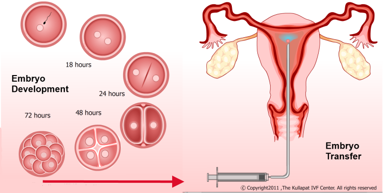 การพัฒนาการของตัวอ่อนและการย้ายตัวอ่อน - กุลพัฒน์การแพทย์ สหคลินิก